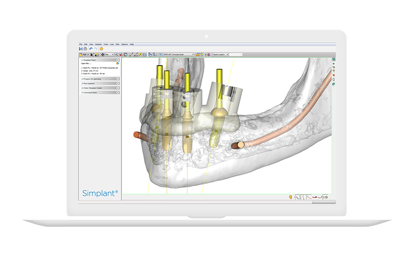 Simplant Pro
